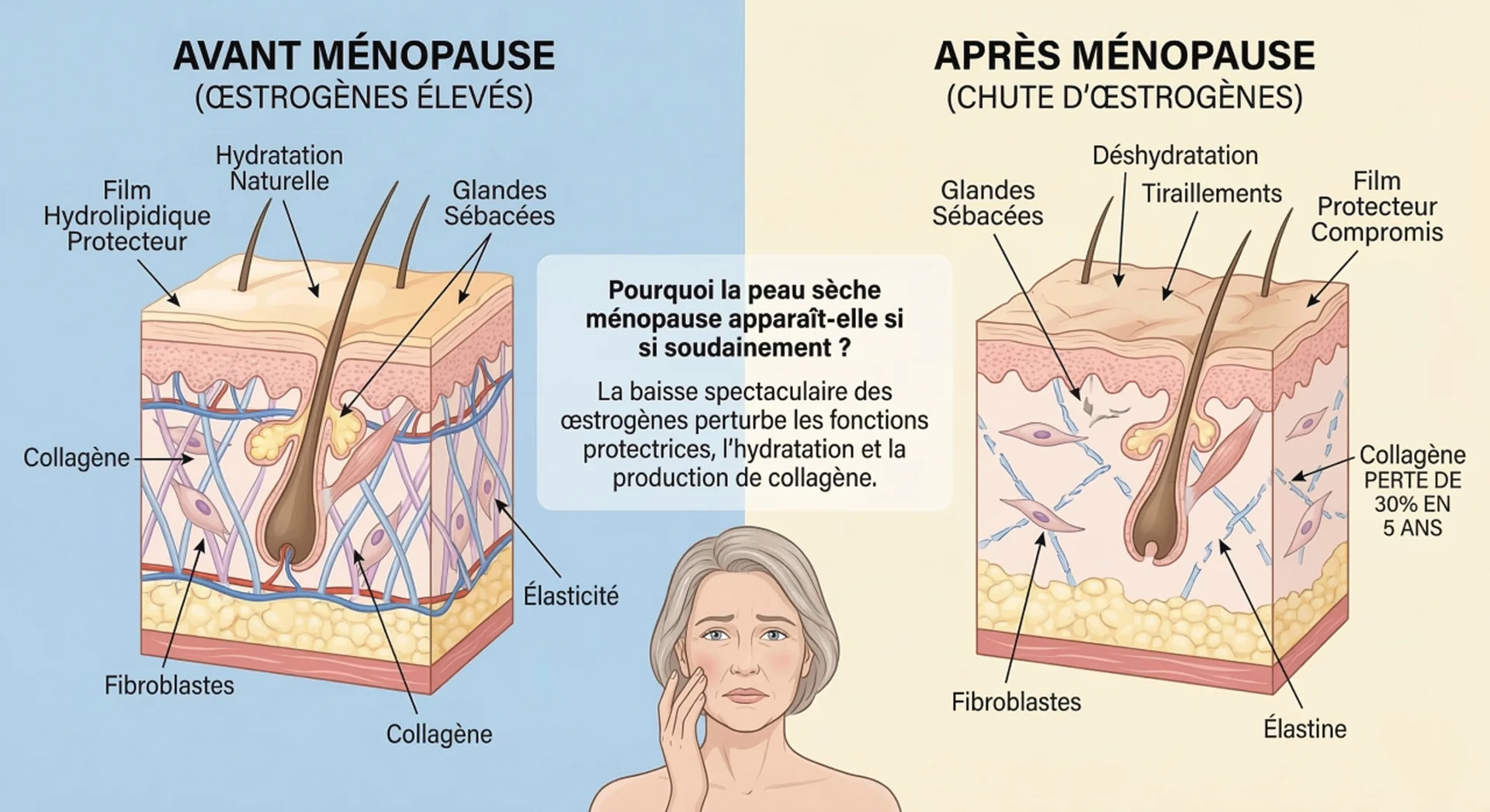 Pourquoi la peau sèche ménopause apparaît-elle si soudainement
